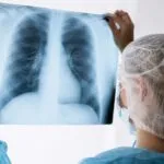 Nanotransportadores pulmón en tratamiento oncológico con precisión y menor toxicidad en España