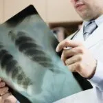 radiografías públicas bajo investigación por colusión en licitaciones del sistema de salud mexicano