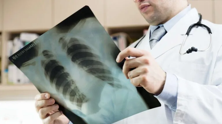 radiografías públicas bajo investigación por colusión en licitaciones del sistema de salud mexicano